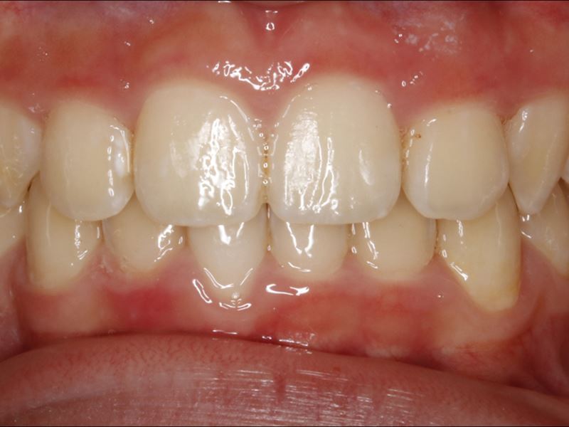 What Is Orthodontic Treatment and Why Is It Important?